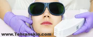 ممکن است شما بتوانید موهای زائد سایر قسمت های بدن خود را بپوشانید اما با موهای زائد صورت خود چه خواهید کرد؟