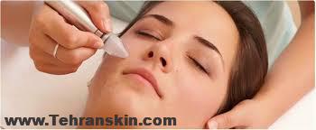 جوش زدن بعد از میکرودرم