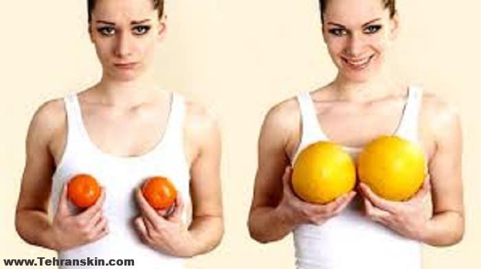 بزرگ کردن و لیفت سینه با طب سوزنی