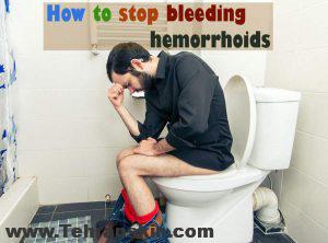 آشنایی با راهکارهایی برای درمان هموروئید | بهترین درمان های خانگی برای هموروئید