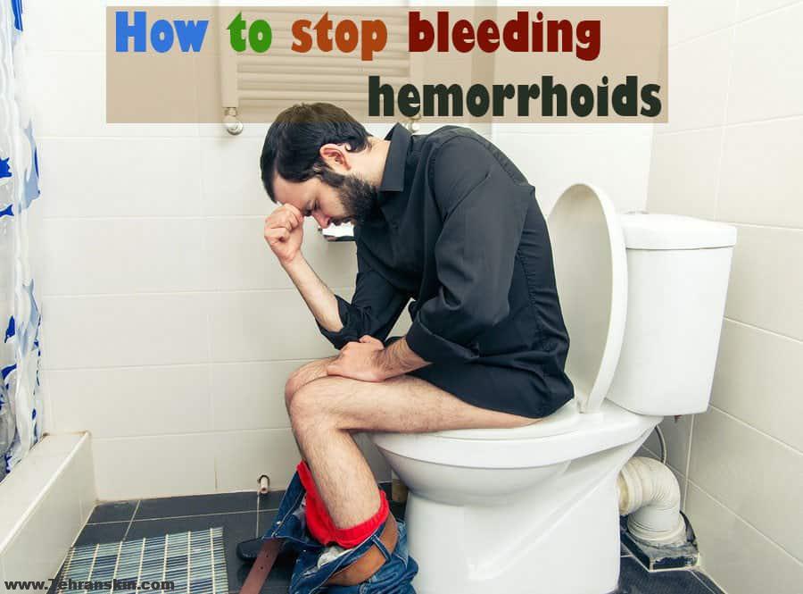 جراحی هموروئید چه تأثیری در درمان کم خونی ناشی از کمبود آهن دارد؟ بهترین جراح هموروئید