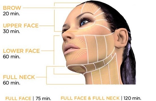 اولتراپی یا هایفوتراپی صورت و گردن