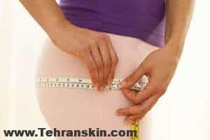 افزایش اندازه باسن با روش های لیفت برزیلی و قرار دادن ایمپلنت | عمل باسن