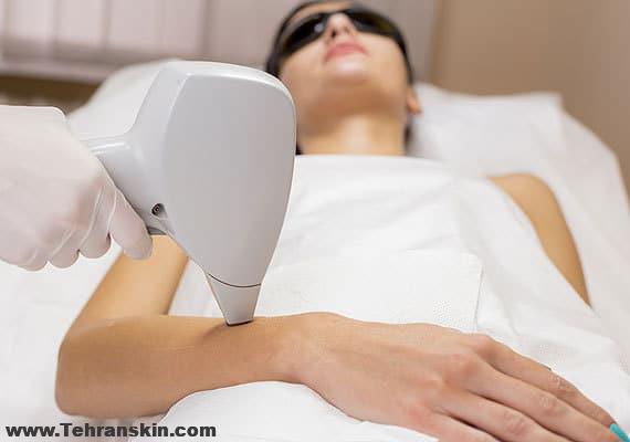 12 کاری که نباید پس از جلسه اول لیزر موهای زائد انجام بدهیم | آدرس مرکز لیزر و زیبایی برکه