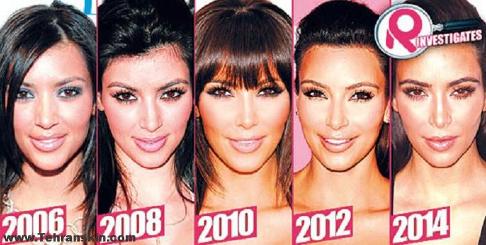 هایفوتراپی بازیگران هالیوود