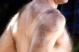 لیزر کامل موهای زائد مردان | پاها ، باسن ، شانه ، بیکینی | مرکز لیزر موهای زائد