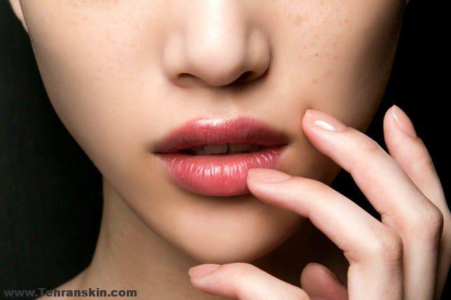 لیزر موهای کرکی