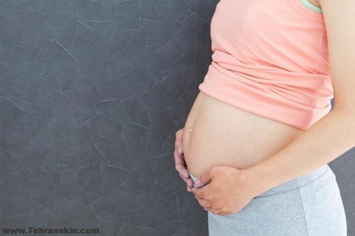 درمان قطعی ترک های پوستی با کربوکسی تراپی