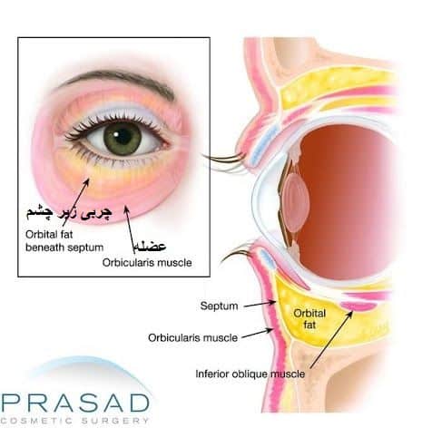 آناتومی زیر چشم 