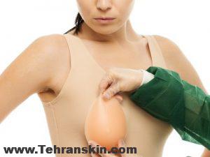 آیا پروتز سینه باعث سرطان می شود؟ | علائم سرطان پستان مرتبط با پروتز | عوارض ایمپلنت سینه