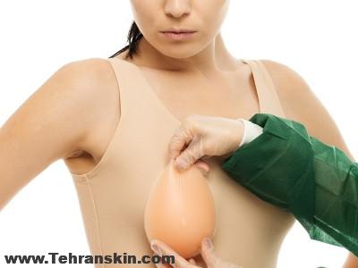 آیا پروتز سینه باعث سرطان می شود؟ | علائم سرطان پستان مرتبط با پروتز | عوارض ایمپلنت سینه