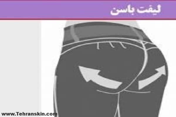 رفع افتادگی و جراحی لیفت باسن | روش جراحی ، مزایا و عوارض و نتایج عمل