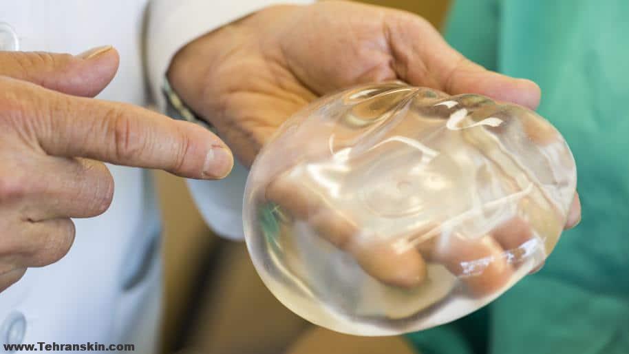 بهترین روش برای بزرگ کردن سینه چیست؟ بهترین دکتر پروتز سینه