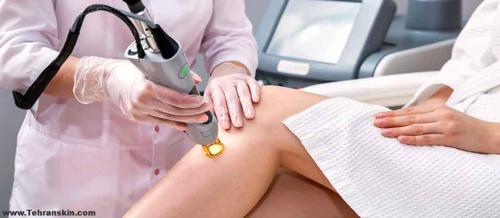 دستگاه لیزر دایود