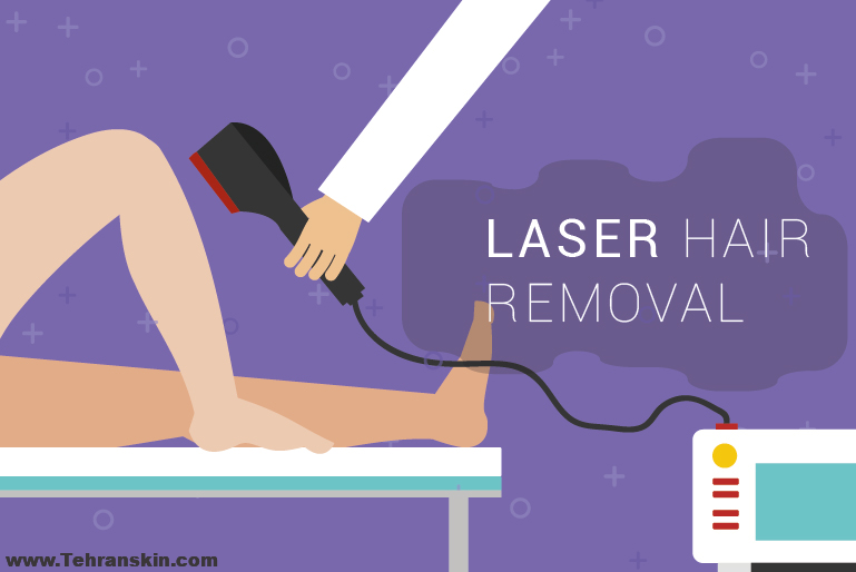 رفع دائمی موهای زائد ناحیه ی تناسلی