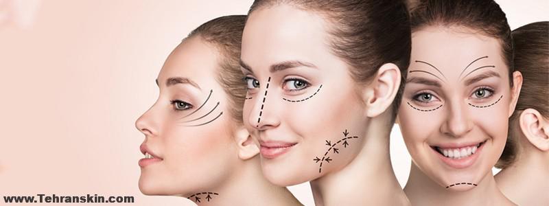 کارایی میکرونیدلینگ