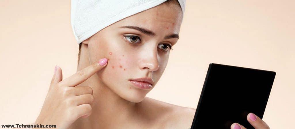 هزینه میکرونیدلینگ برای جای جوش