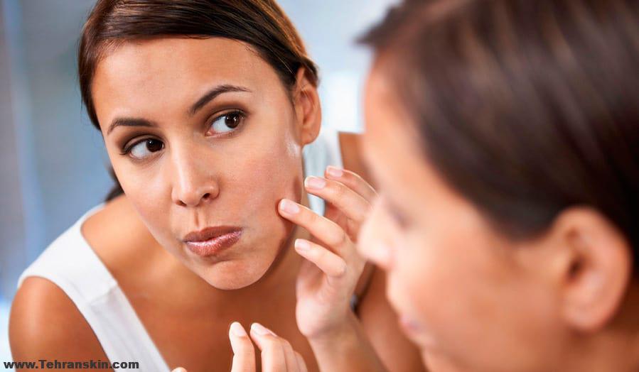 میکرونیدلینگ کجا برم