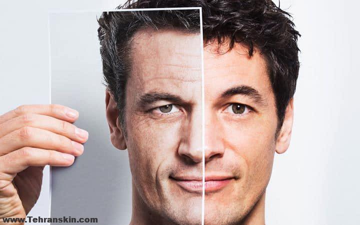 جوان سازی پوست صورت آقایان
