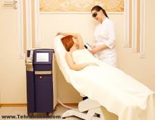 7 شایعه رایج در مورد حذف موهای زائد با لیزر | بهترین مرکز لیزر تهران کجاست؟
