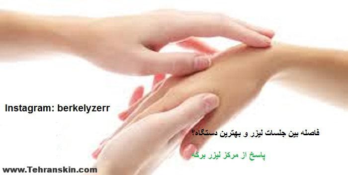 فاصله جلسات لیزر موهای زائد دست ها و پاها