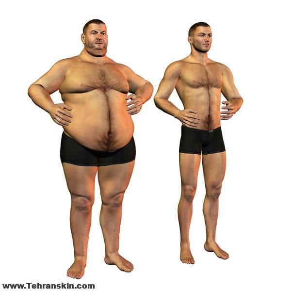 مشاوره پیکرتراشی در تهران: مفیدترین اطلاعات را دریافت کنید.