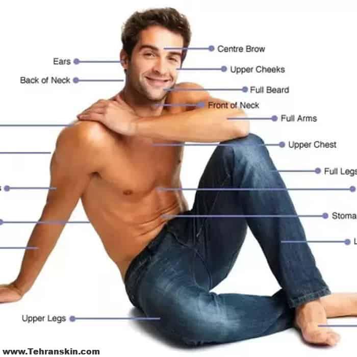 فیلم لیزر موهای زائد بدن آقایان دستگاه اسکلپیون مدیواستار