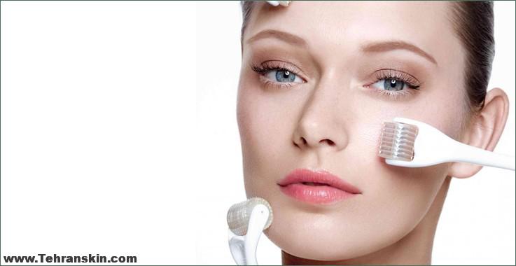 درمان میکرونیدلینگ