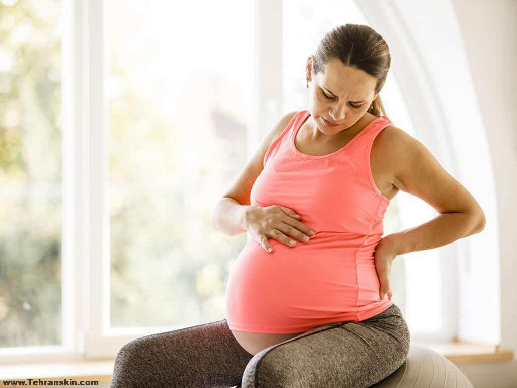 در دوران حاملگی از چه پمادهایی برای هموروئید استفاده کنیم؟| کرم های آنتی هموروئید