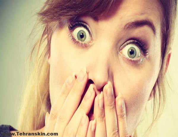 داستان ترس من از لیزر موهای زائد | لیزر اسکلپیون مدیواستار بدون درد بدون ترس