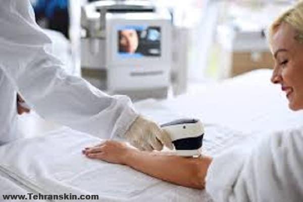 چرا موهای من بعد از لیزر موهای زائد هنوز نریخته؟ چقدر طول می کشد تا موها بریزند؟