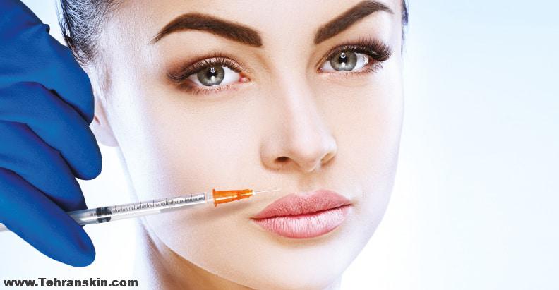 تزریق فیلر لب
