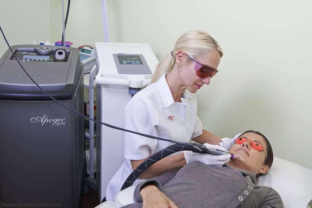 آیا لیزر موهای زائد موثر است؟