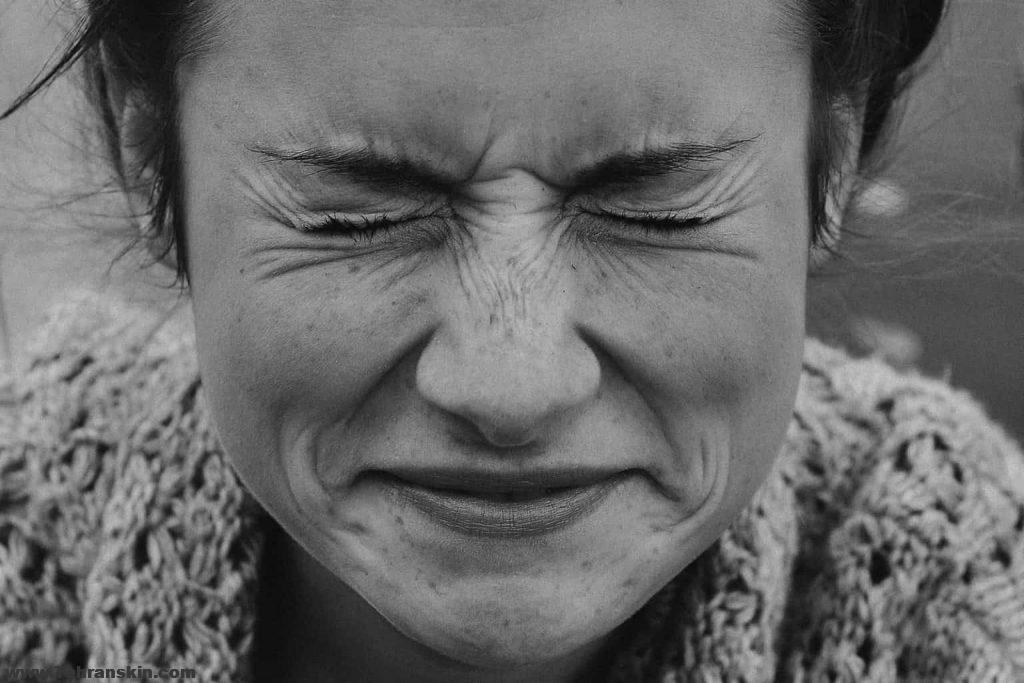 بوتاکس خط خنده