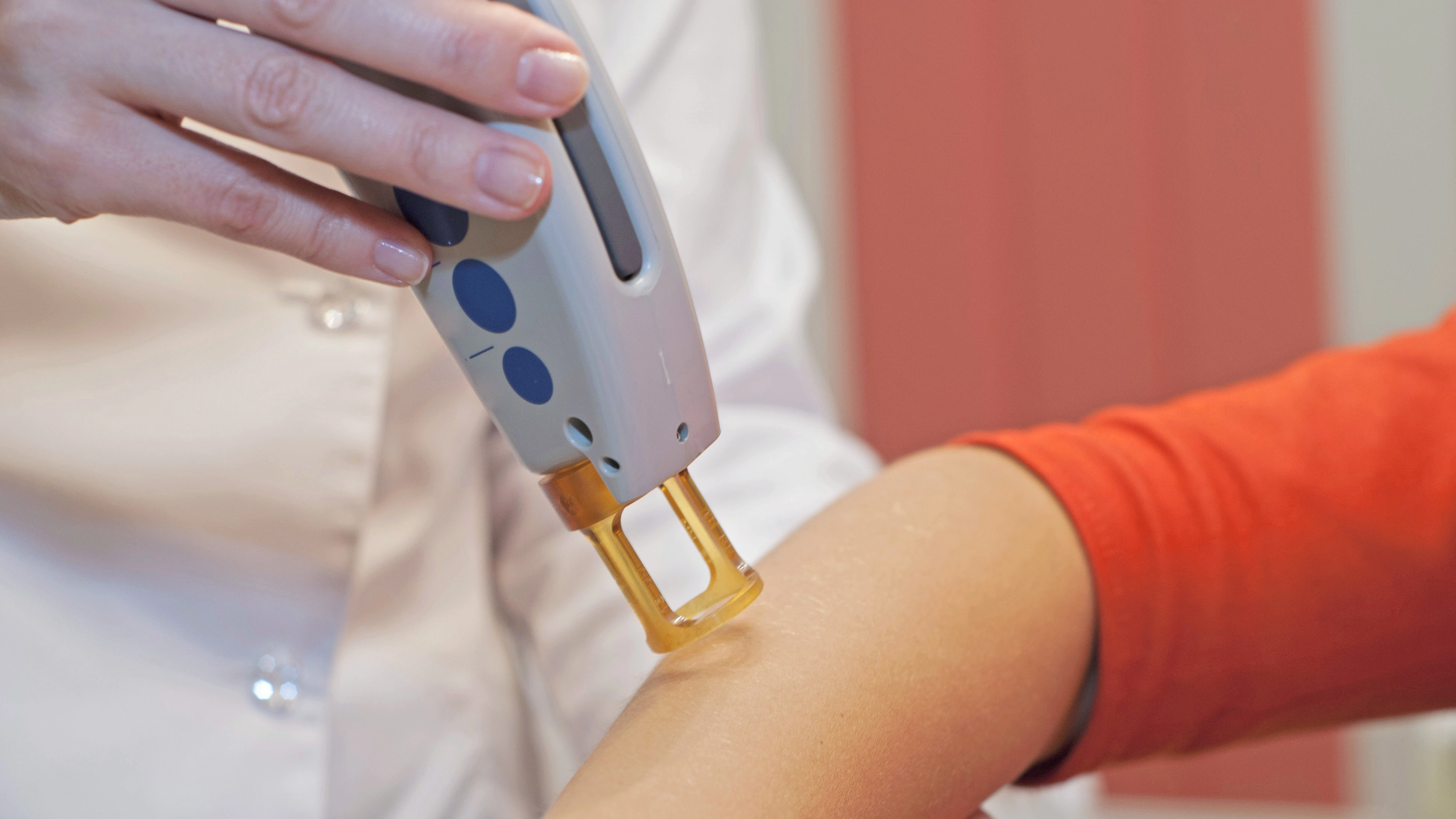 از بین بردن موهای دست