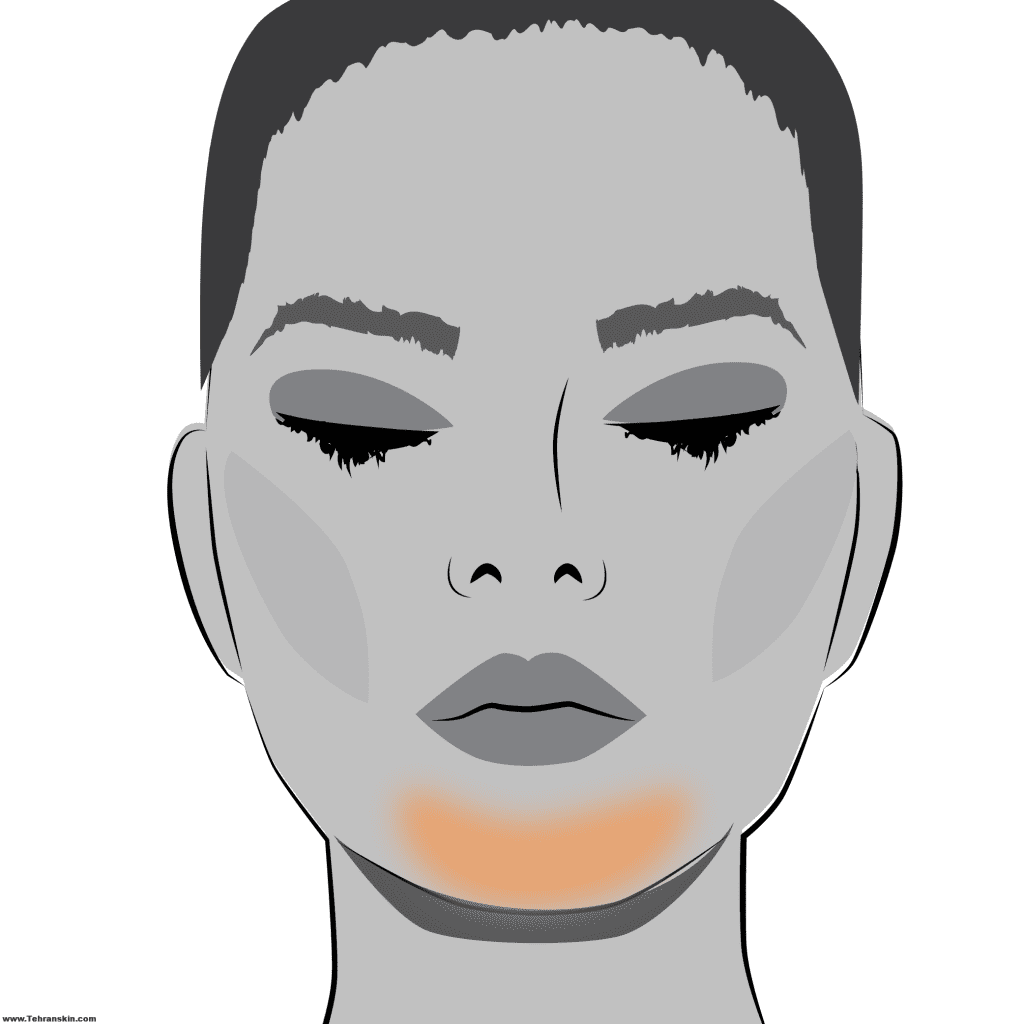 از بین بردن موهای زائد زیر چانه