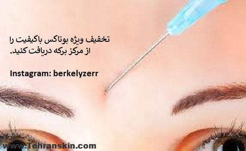 مشاهده تخفیف بوتاکس دیسپورت مرکز برکه