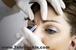 بوتاکس درد داره ؟ چطوری از عوارض بوتاکس پیشگیری کنیم؟ تزریق بوتاکس در مرکز لیزر و زیبایی برکه + فیلم بوتاکس درد داره ؟ چطوری از عوارض بوتاکس پیشگیری کنیم؟ تزریق بوتاکس در مرکز لیزر و زیبایی برکه + فیلم