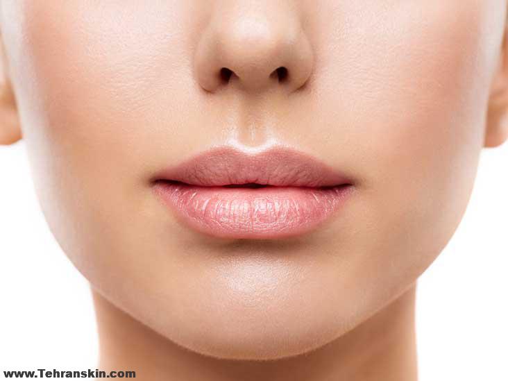 فلیپ لب با بوتاکس | بزرگ کردن لب با بوتاکس | لیفت لب با بوتاکس |