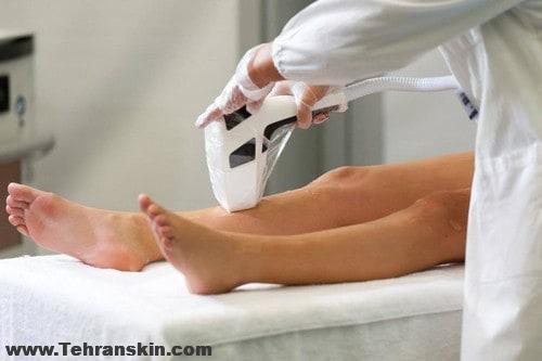 7 شایعه رایج در مورد حذف موهای زائد با لیزر | بهترین مرکز لیزر تهران کجاست؟