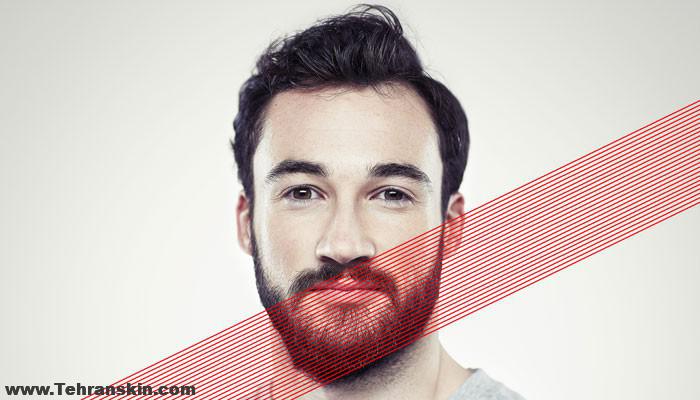 لیزر موهای زائد گونه