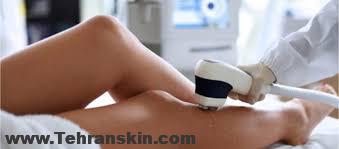 چند نکته که ای کاش قبل از لیزر موهای زائد می دانستم |بهترین مرکز لیزر موهای زائد