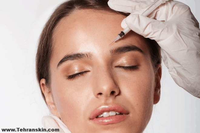 رفع چروک پیشانی