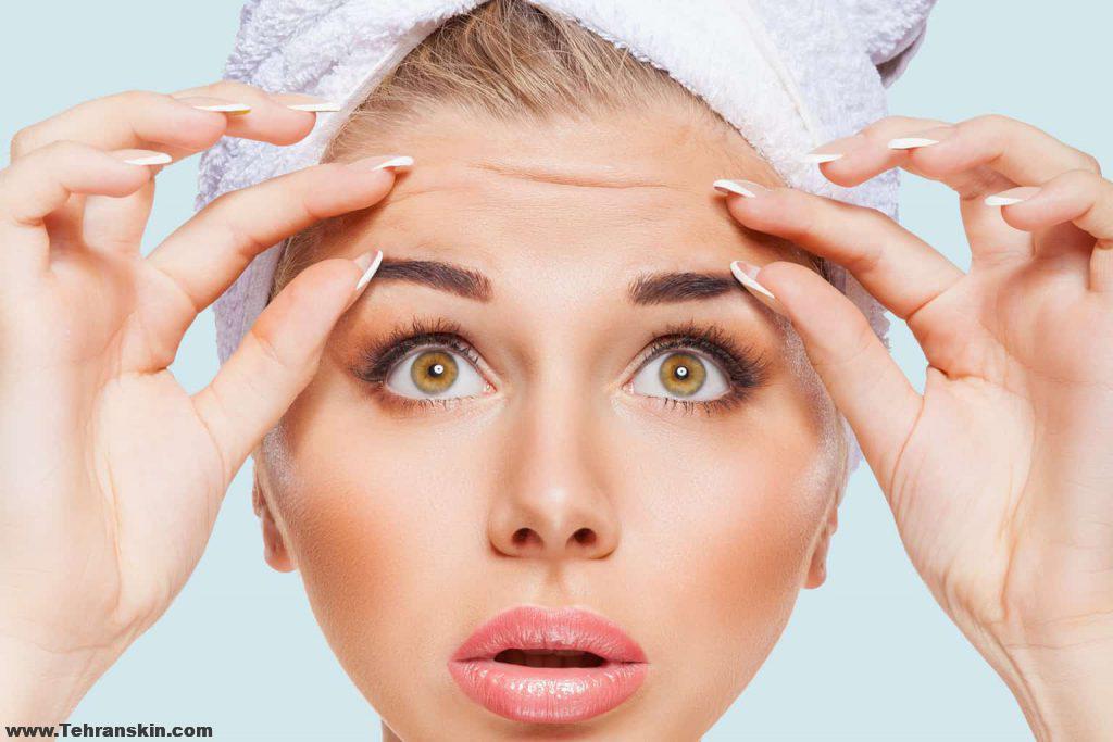 تخفیف تزریق بوتاکس