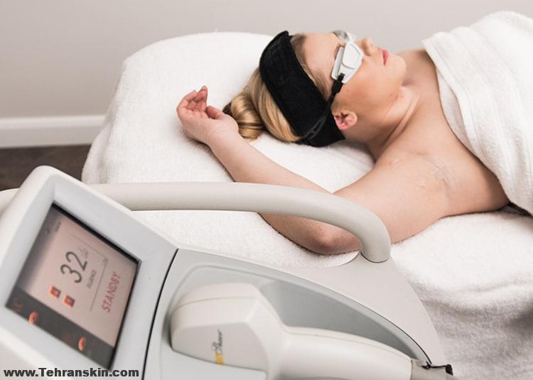 قیمت لیزر کردن موهای زائد بدن