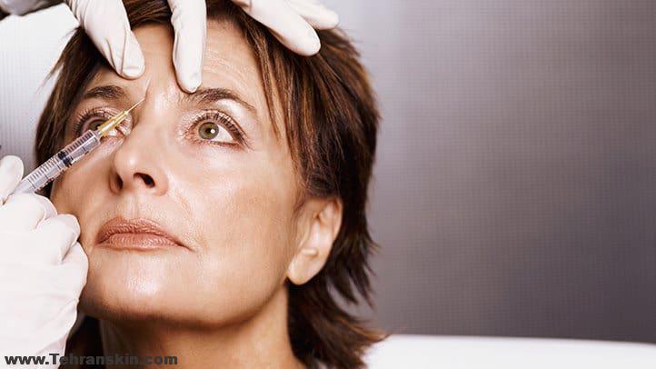 تزریق بوتاکس لینوریز