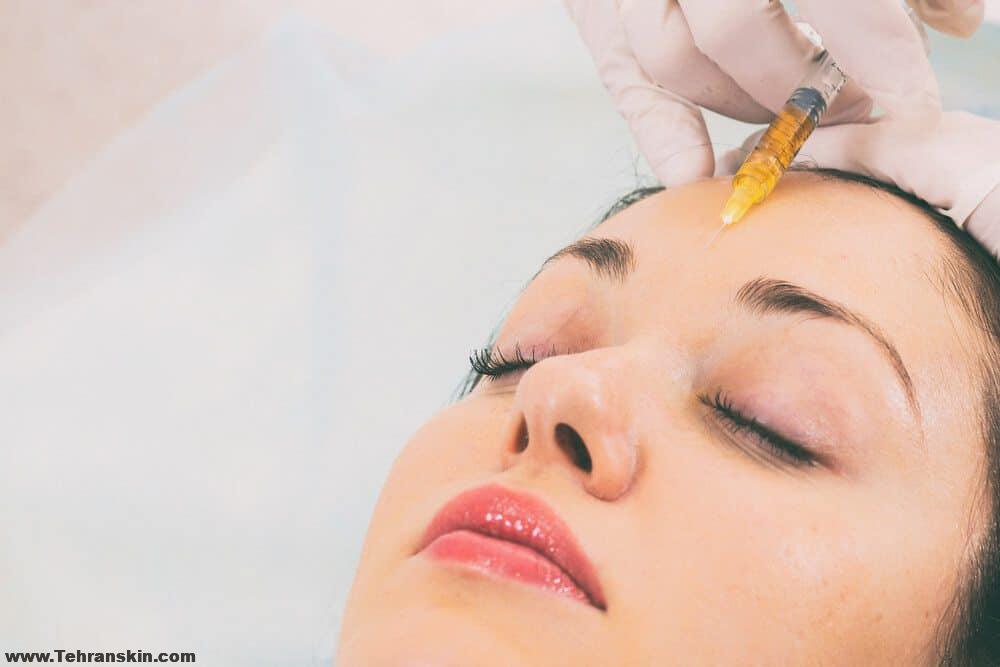 قیمت بوتاکس خط اخم