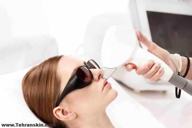 اپراتور لیزر موهای زائد