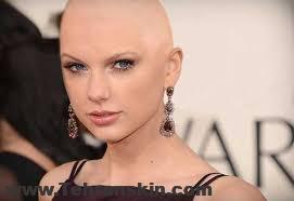 درمان کچلی ارثی در زنان | نشانه های ریزش موی ارثی | کاشت مو