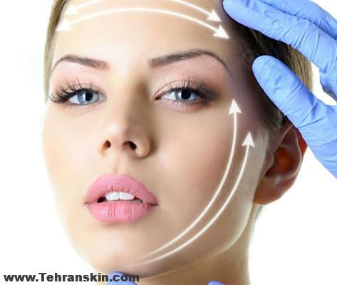 پروتز چانه | متعادل سازی چانه های فرو رفته و کوچک | بهترین مرکز زیبایی در تهران